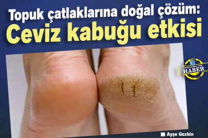 Topuk çatlaklarına doğal çözüm: Ceviz kabuğu etkisi