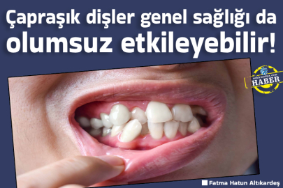 Çapraşık dişler genel sağlığı da olumsuz etkileyebilir!