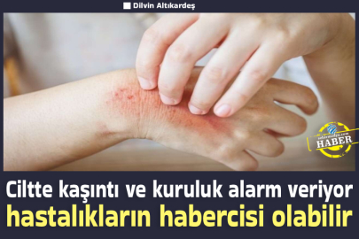 Ciltte kaşıntı ve kuruluk alarm veriyor hastalıkların habercisi olabilir