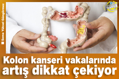 Kolon kanseri vakalarında artış dikkat çekiyor