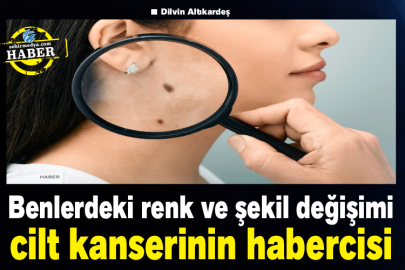Benlerdeki renk ve şekil değişimi cilt kanserinin habercisi
