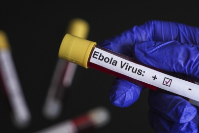 Kongo Demokratik Cumhuriyeti'nde 900'den fazla şüpheli Ebola vakasının görüldüğü bildirildi