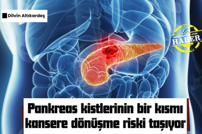 Pankreas kistlerinin bir kısmı kansere dönüşme riski taşıyor