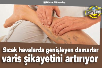 Sıcak havalarda genişleyen damarlar varis şikayetini artırıyor