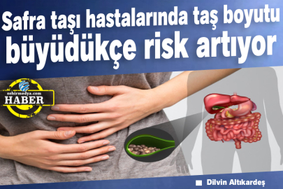 Safra taşı hastalarında taş boyutu büyüdükçe risk artıyor