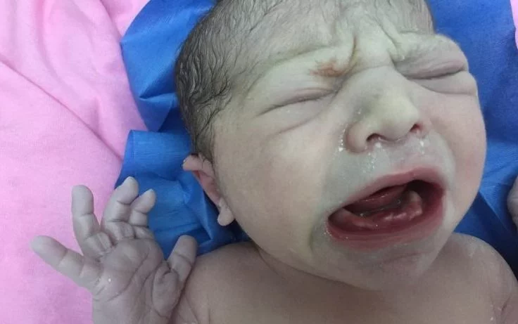 Doktorlar şok oldu! Yeni doğan bebeğin ağzında...