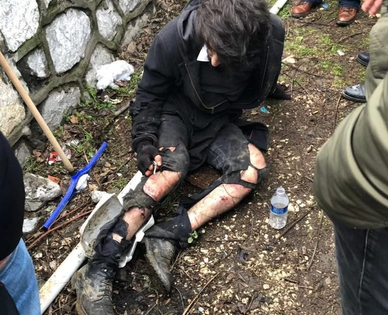 Bursa'da köpek dehşeti! Üniversite öğrencisine saldırdı