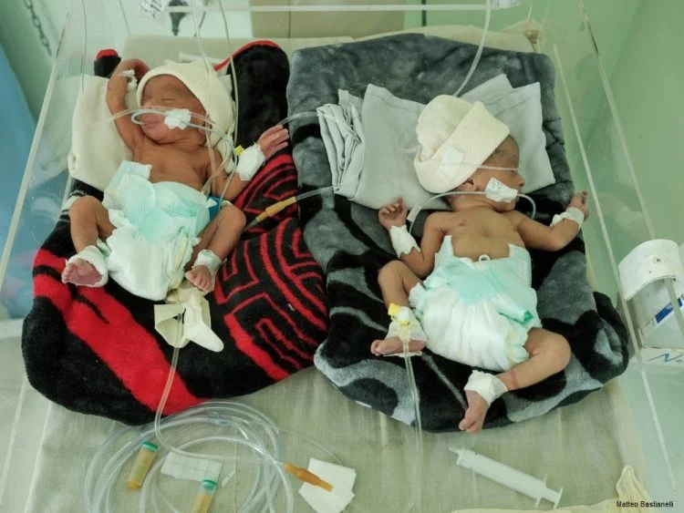 Yemen'de anne ve çocuklar ölümün pençesinde