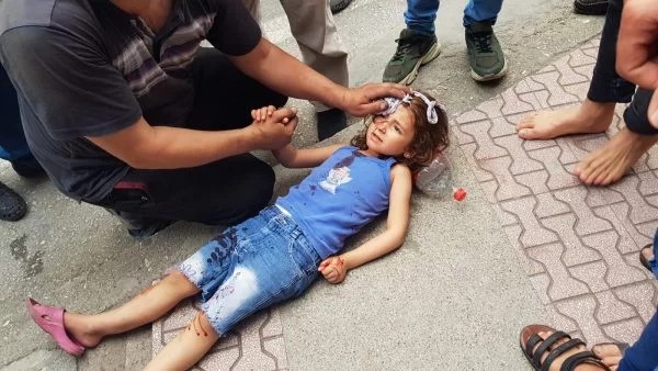 Suriyeli küçük kız trafik kazasında ağır yaralandı