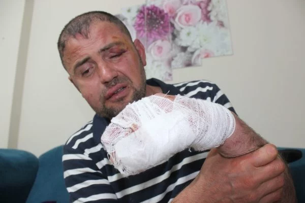 Bursalı Gazi gittiği kafede öldüresiye dövüldü