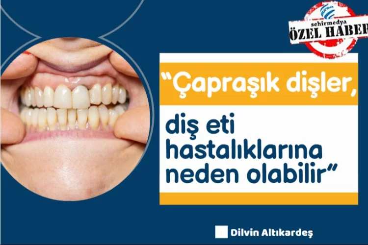 “Çapraşık dişler, diş eti hastalıklarına neden olabilir”