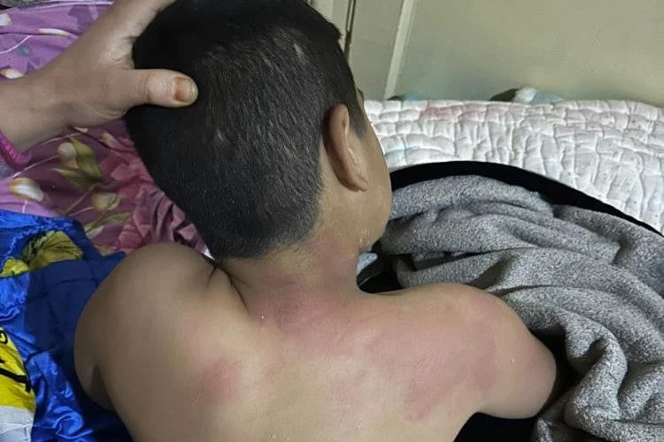 Suriyeli çocuğa ırkçılık kokan vahşi saldırı : CHP ofisinde 10 yaşında çocuğu kaynar çayla haşladılar!