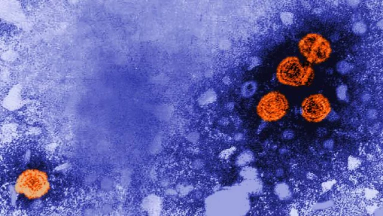 Gizemli hepatit yayılıyor: 15 şüpheli vaka daha